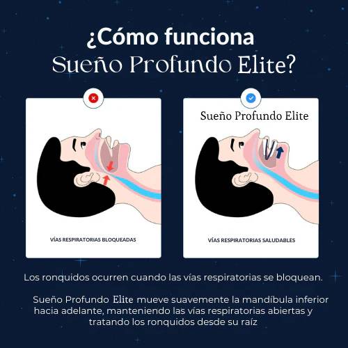 ¡Últimas 23 unidades disponibles! Duerme tranquilo desde hoy 😴📦 Sueño Profundo Elite™ Dispositivo Bucal Anti-Ronquidos